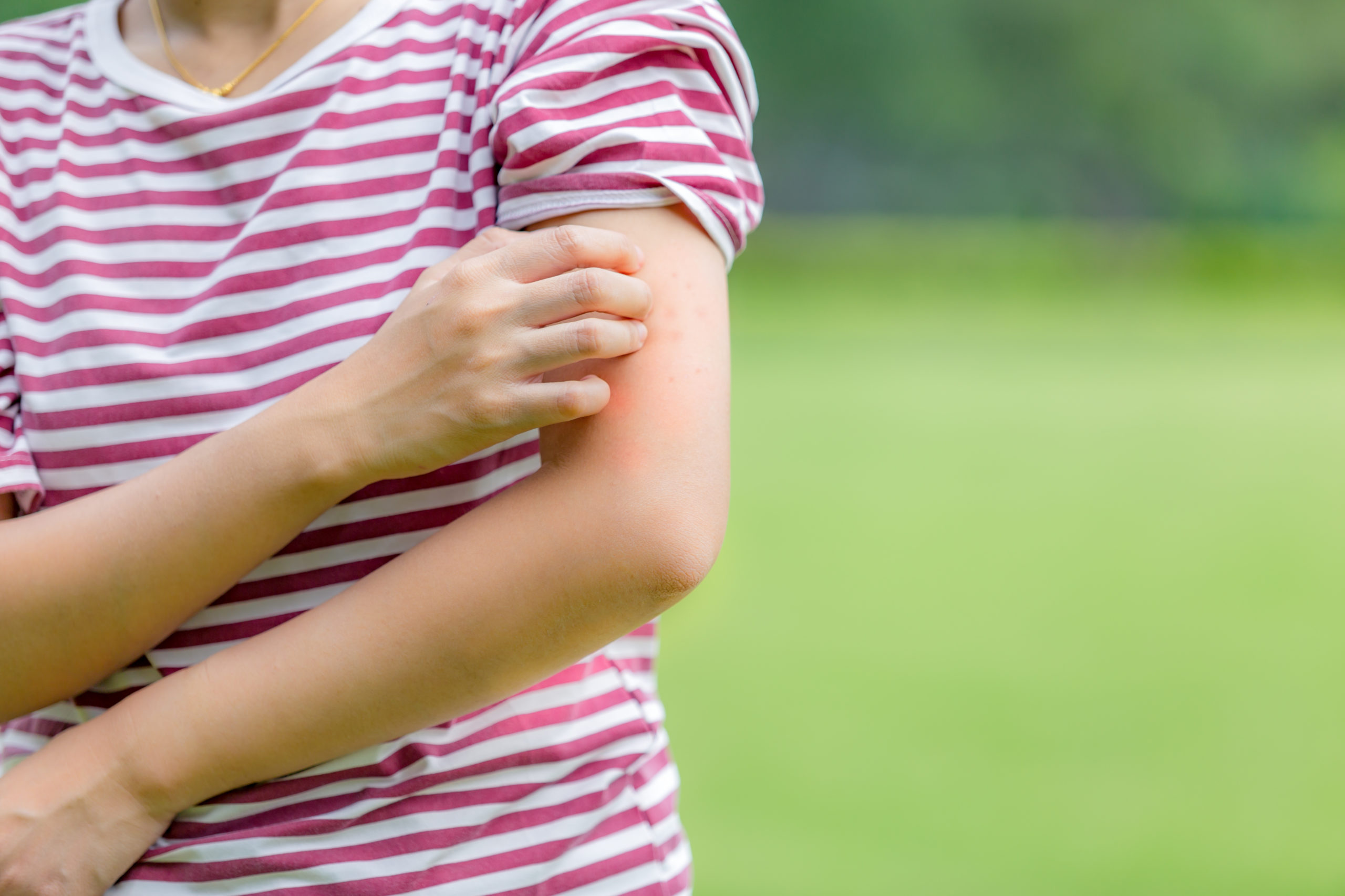 Mosquito Bite Prevention Information for Pregnant Woman Atlanta